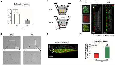 Distinct Migratory Properties of M1, M2, and Resident Macrophages Are Regulated by αDβ2 and αMβ2 Integrin-Mediated Adhesion